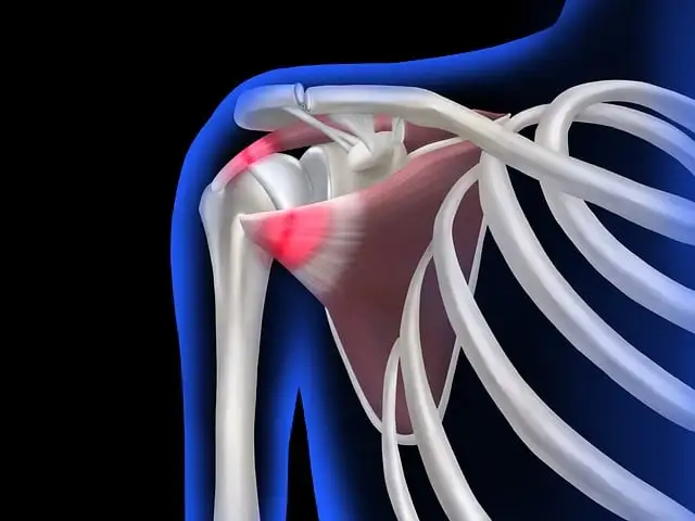  shoulder pain