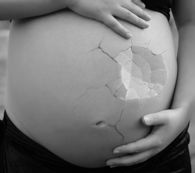 miscarriage