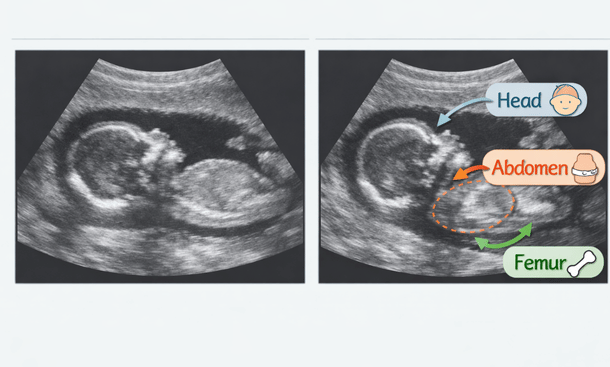 Fetal Ultrasound Measurements