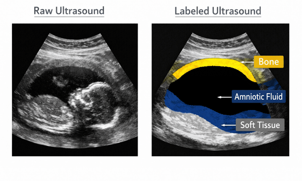 Ultrasound Diagram Comparison