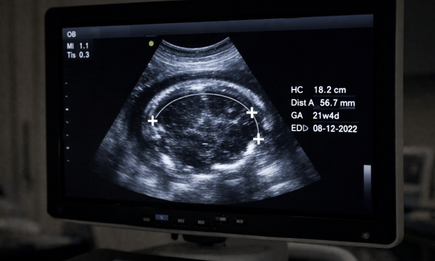 Ultrasound Measurement Display