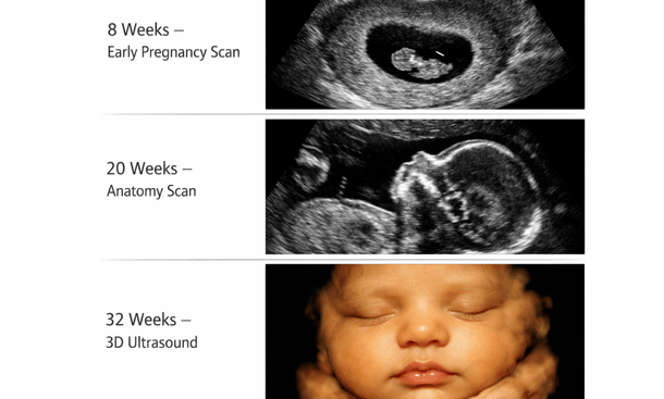 Ultrasound Pregnancy Progression