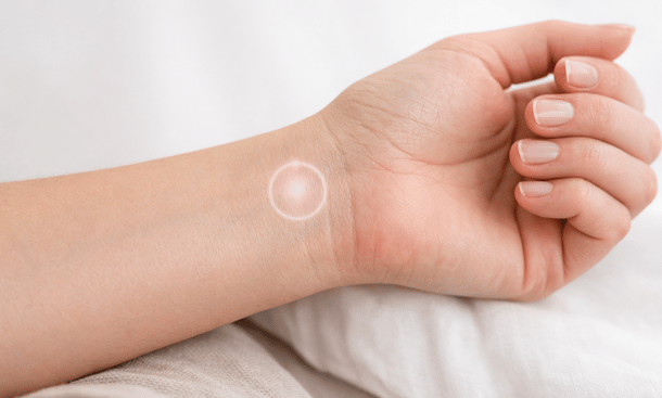 Wrist Acupressure Point