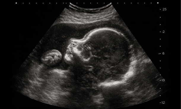 Intimate Ultrasound Keepsake