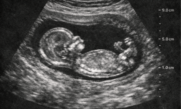 Ultrasound Fetal Profile
